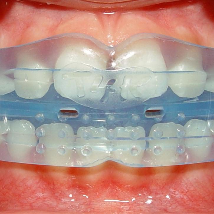 teeth-1652976_1280-1